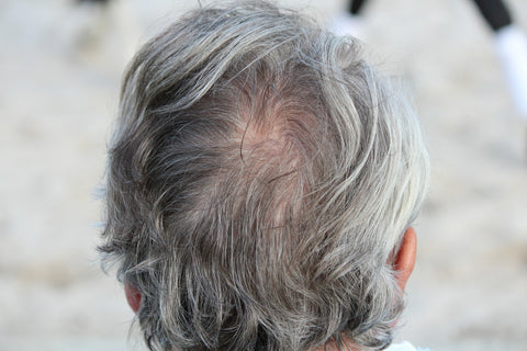 Grey hair