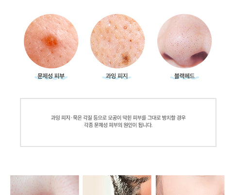 모공 속 노페물<br>말끔하게 제거해보세요<br>몬스터팩토리 진공 피지 제거기