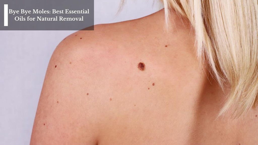 Bye Bye Moles: Best Essential Oils for Natural Removal