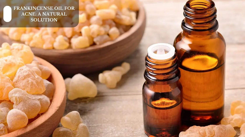 FRANKINCENSE OIL FOR ACNE: A NATURAL SOLUTION