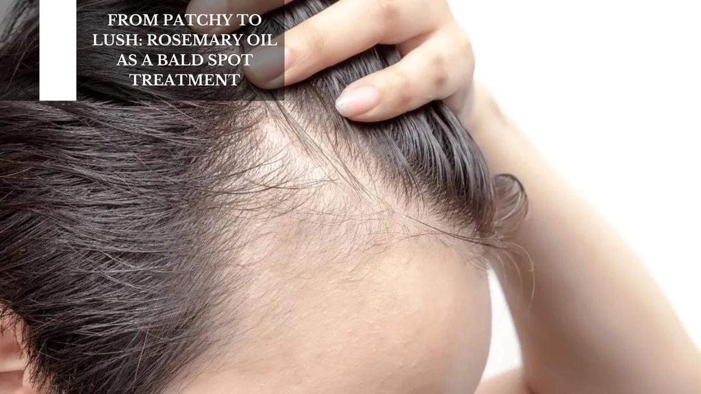 FROM PATCHY TO LUSH: ROSEMARY OIL AS A BALD SPOT TREATMENT