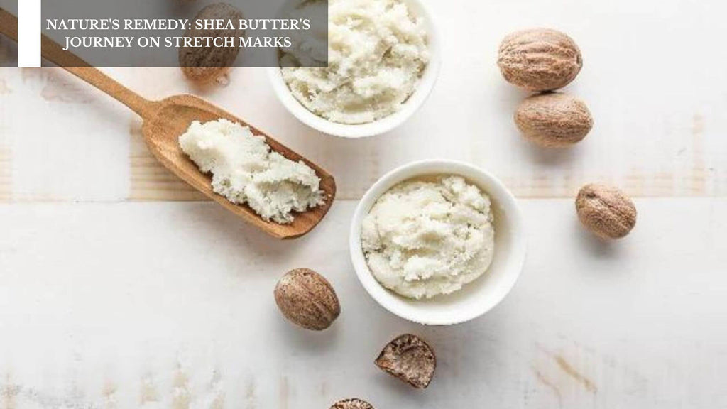 NATURE'S REMEDY: SHEA BUTTER'S JOURNEY ON STRETCH MARKS