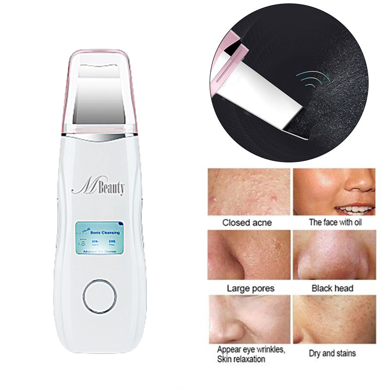 exfoliator spatula, ultrasonic skin scrubber