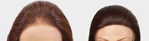Lace wigs (esquerda) X  Perucas normais (direita)