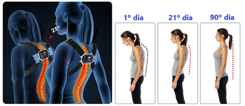 Polideia comprar melhor corretor de postura com sensor vibratório automatico preço do corretor postural barato