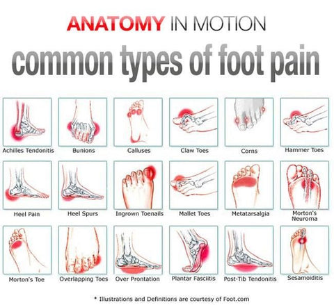 TENS pain therapy for foot pain