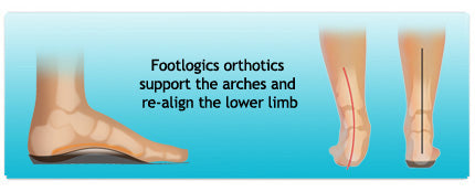 Footlogics orthotics support your feet
