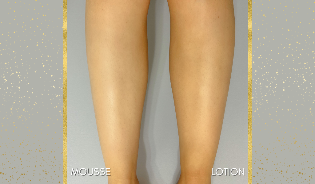Sunless tanning results: left leg, lotion; right leg, mousse.