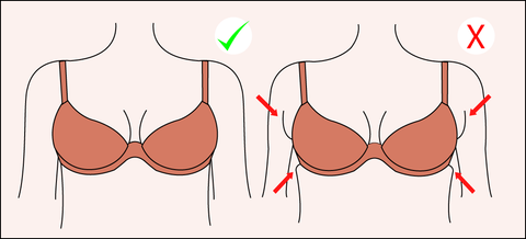 Examples of ill-fitting bras; (i) – Band not level; (ii) – Band