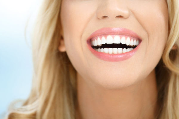 perfect smile veneers