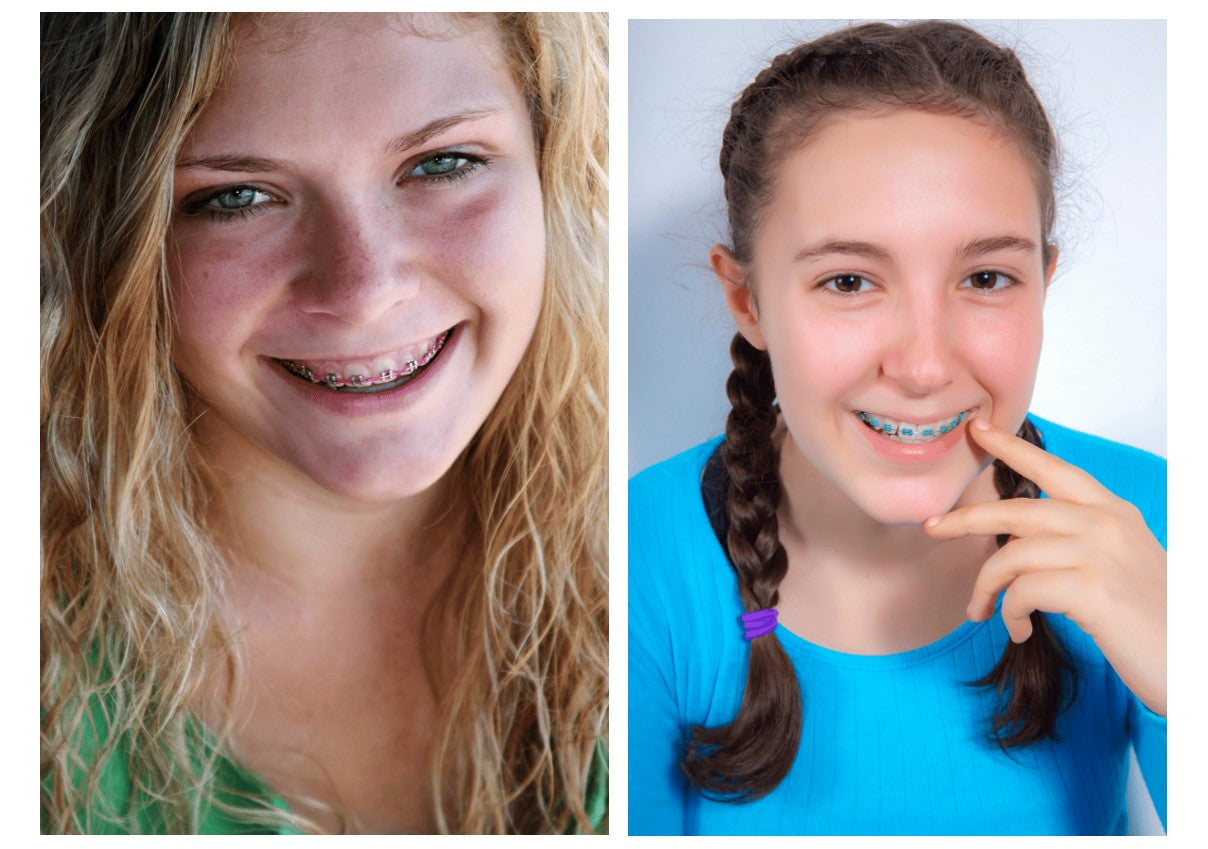 A blonde girl  on the left with green eyes and pink-colored dental braces, A young girl on the right with brown eyes and blue-colored dental braces