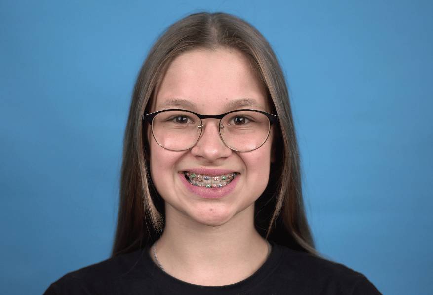 A young girl wearing braces with multi-colored ligatures