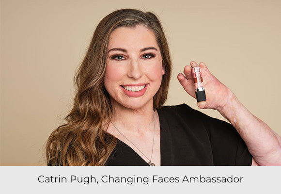 Catrin Pugh, Changing Faces Ambassador 