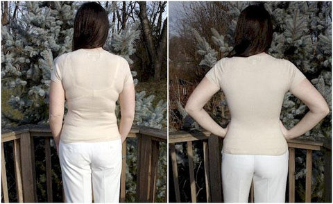 The Importance of wearing shapewear after surgery