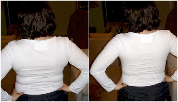 Real Life transformations in our "No Back Fat Bra" - Before & After Pictures - Shapeez