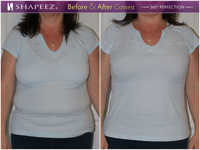 Before & After - Shapeez Canada