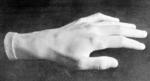 Chopin's left hand, after a moulding by Clesinger