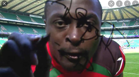 Collins Injera Signs an Autograph on a TV Camera Lens