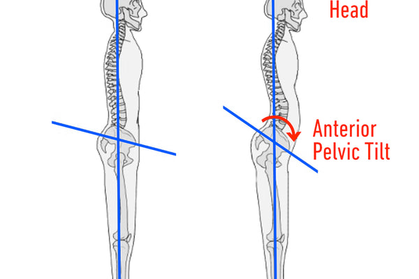 Anterior Pelvic Tilt – Sure Squat