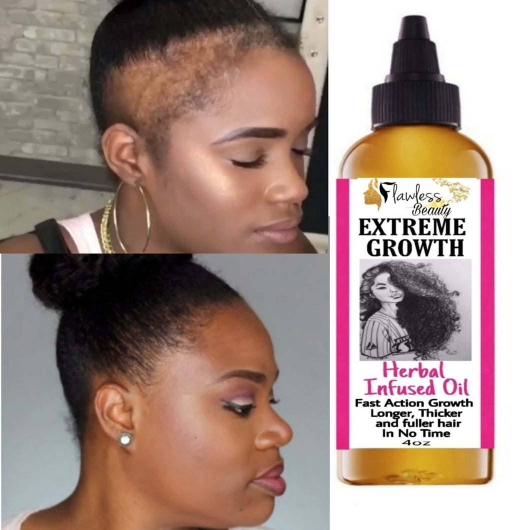Chebe Fast Hair Growth Oil/ Huile Chebe Pour Pousse De Cheveux Rapide –  Forever Glowing