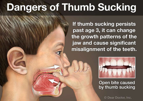 Dangers of Thumb Sucking