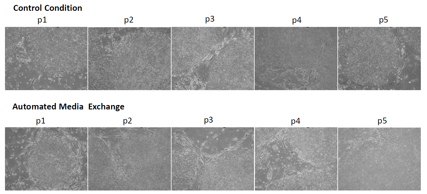 Embryoid Bodies (EB) of mouse iPS cells