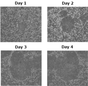 Embryoid Bodies (EB) of mouse iPS cells