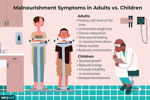 malnutrition symptoms