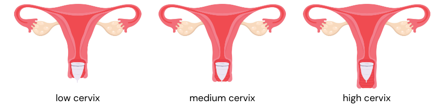 low cervix menstrual cup