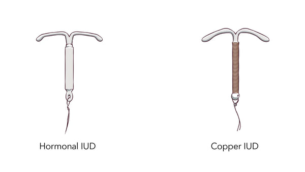 hormonal IUD or non-hormonal copper IUD