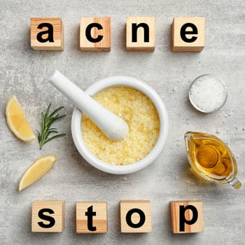 stop acne graphic