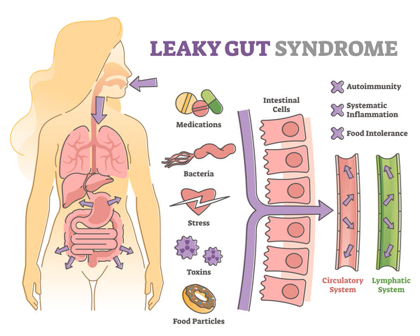 Leaky Gut Syndrome Symptoms