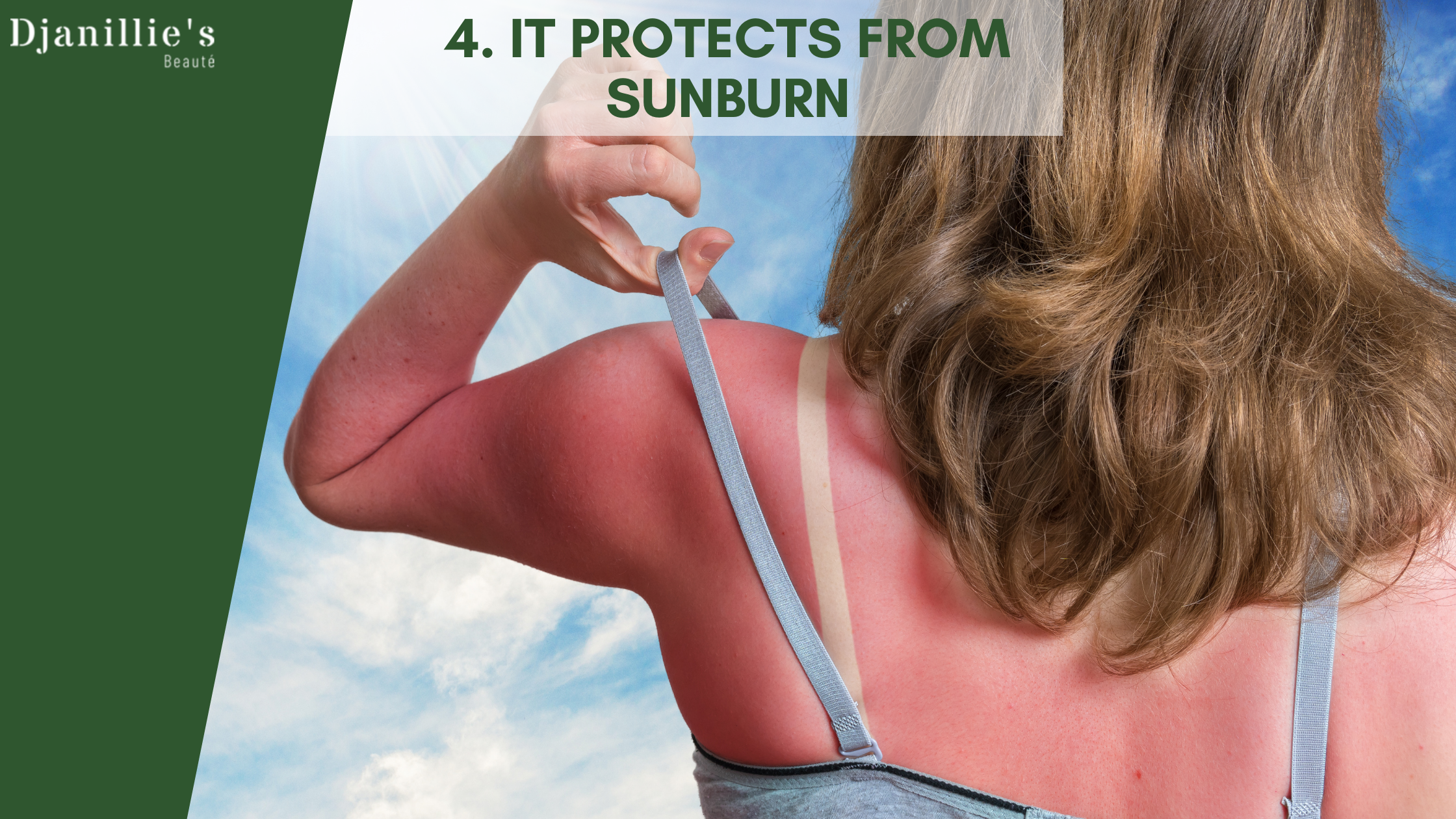 It protects from sunburn