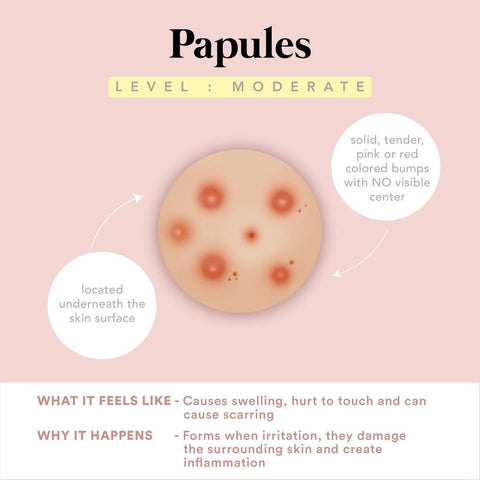 Papules