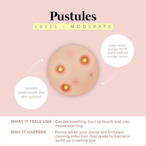 Pustules