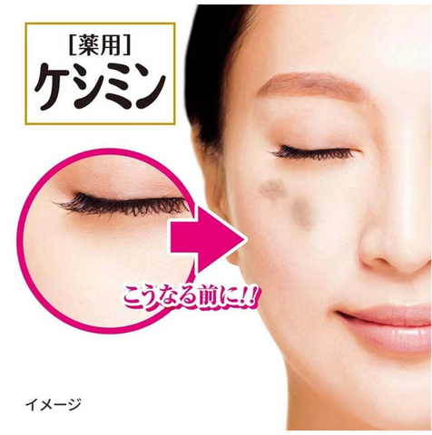Goodsania Japan Keshimin Cream f 30g (quasi-drug) Blemish-free Pigment Clear Japan Skin Care