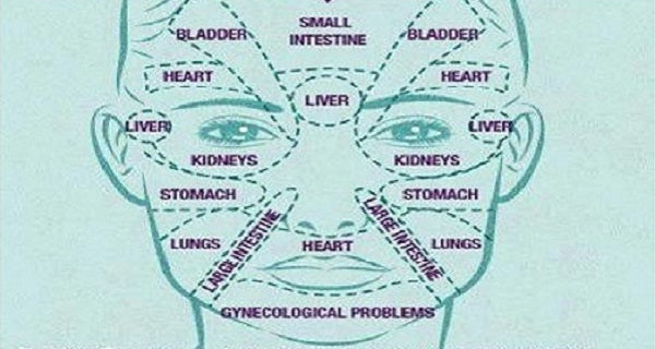 acne diagram of the face