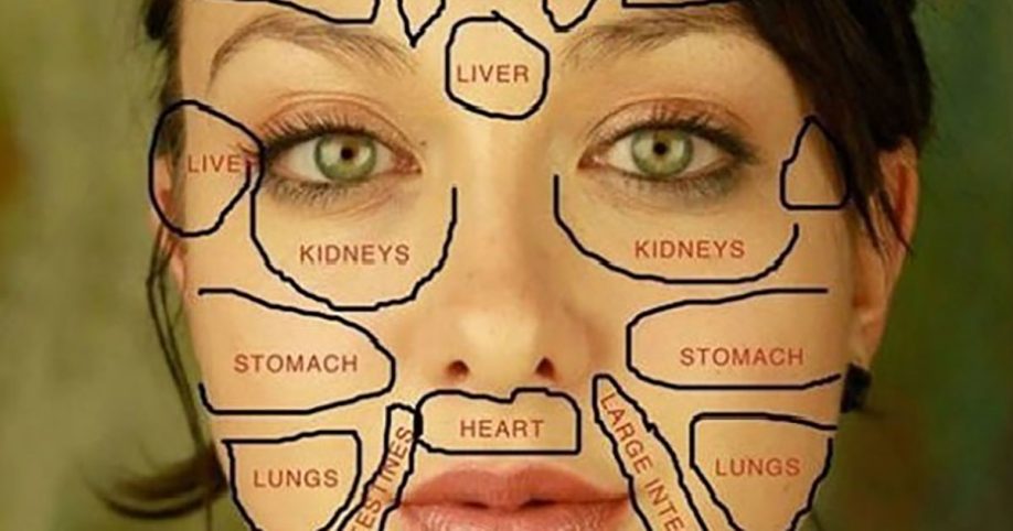 acne diagram of the face