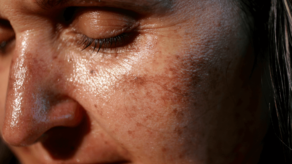 Tâches sur la peau: quelles causes et remèdes?