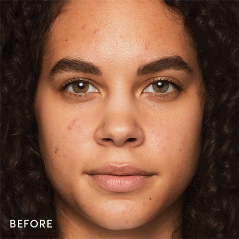 best makeup for acne before and after