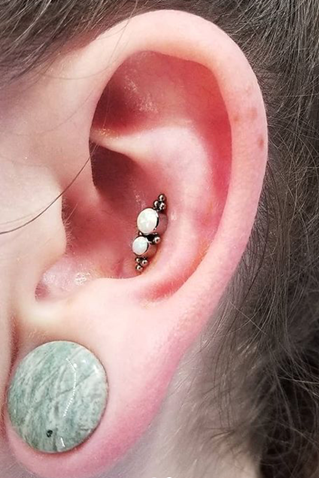 Stretched ear with plug