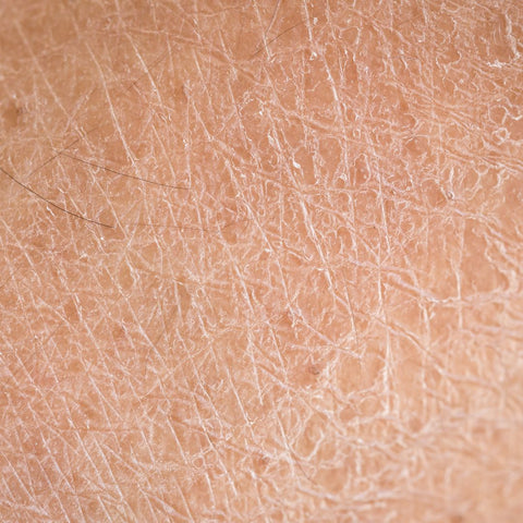 Close-up of dried skin