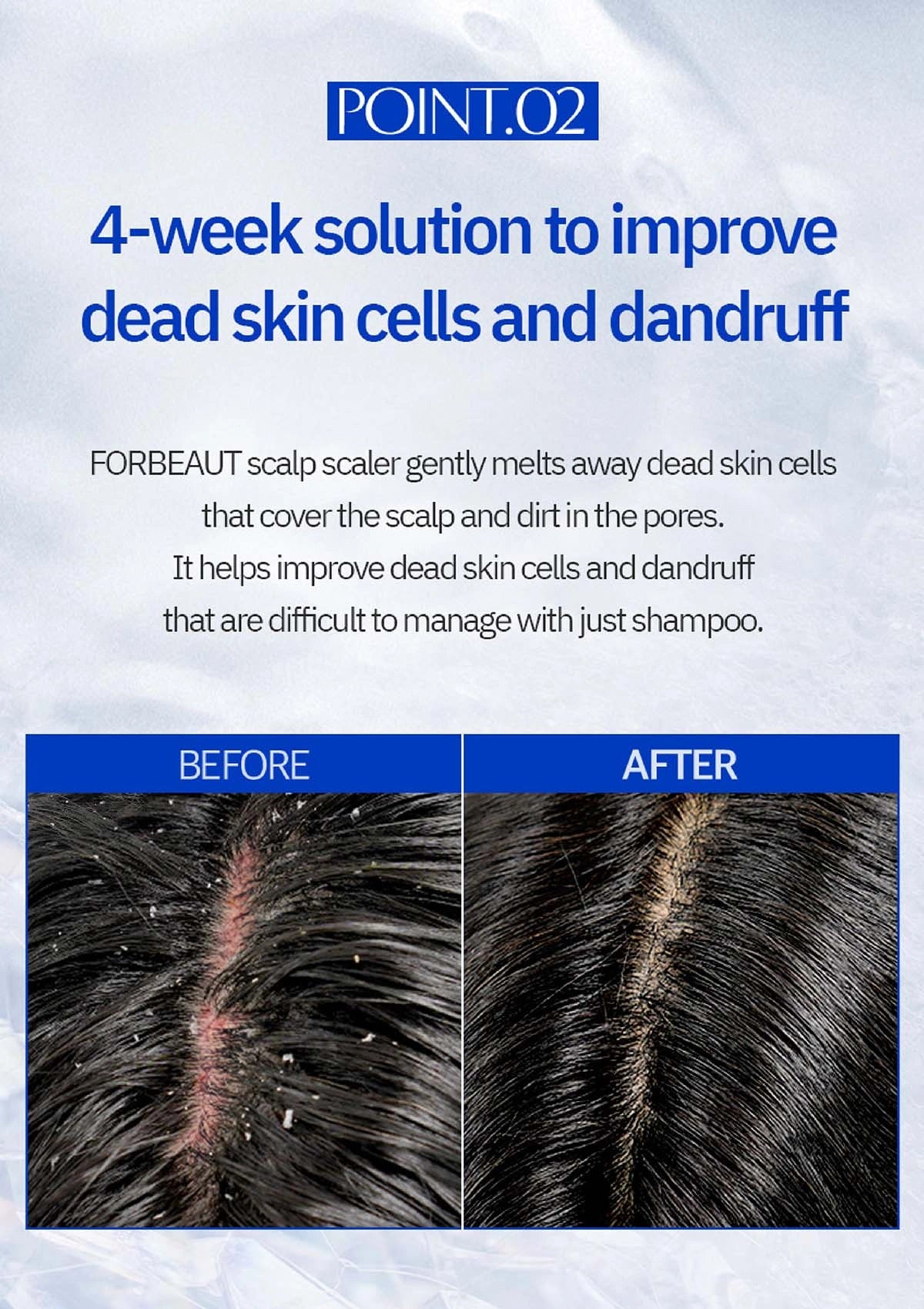 Advertisement for FORBEAUT scalp scaler with before and after images of scalp condition.