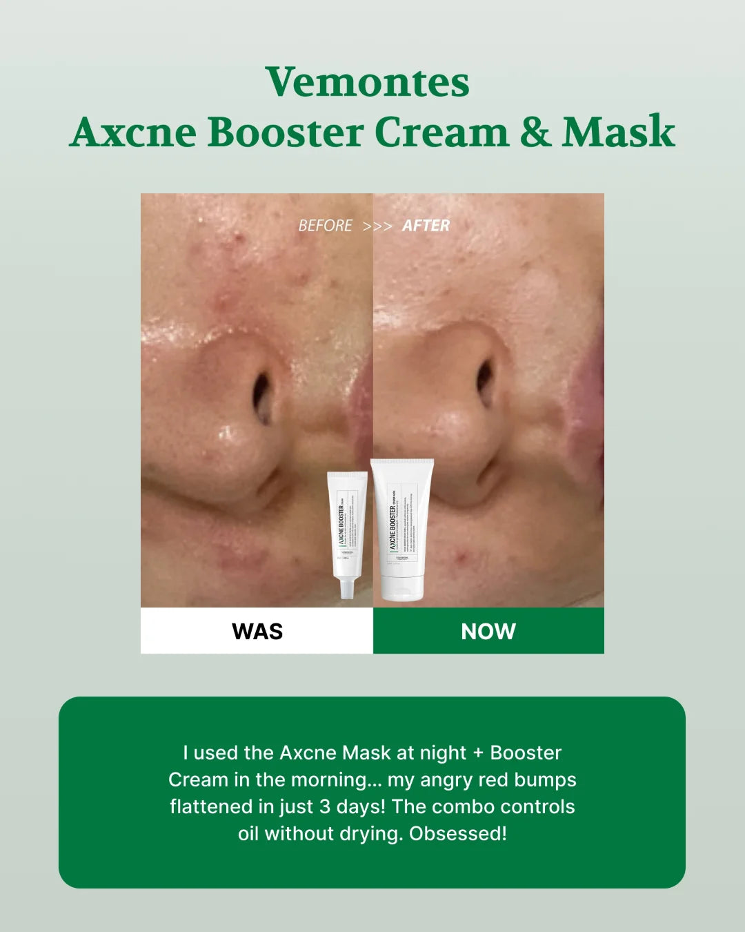 Vemontes Booster Mask & Cream Real Review
