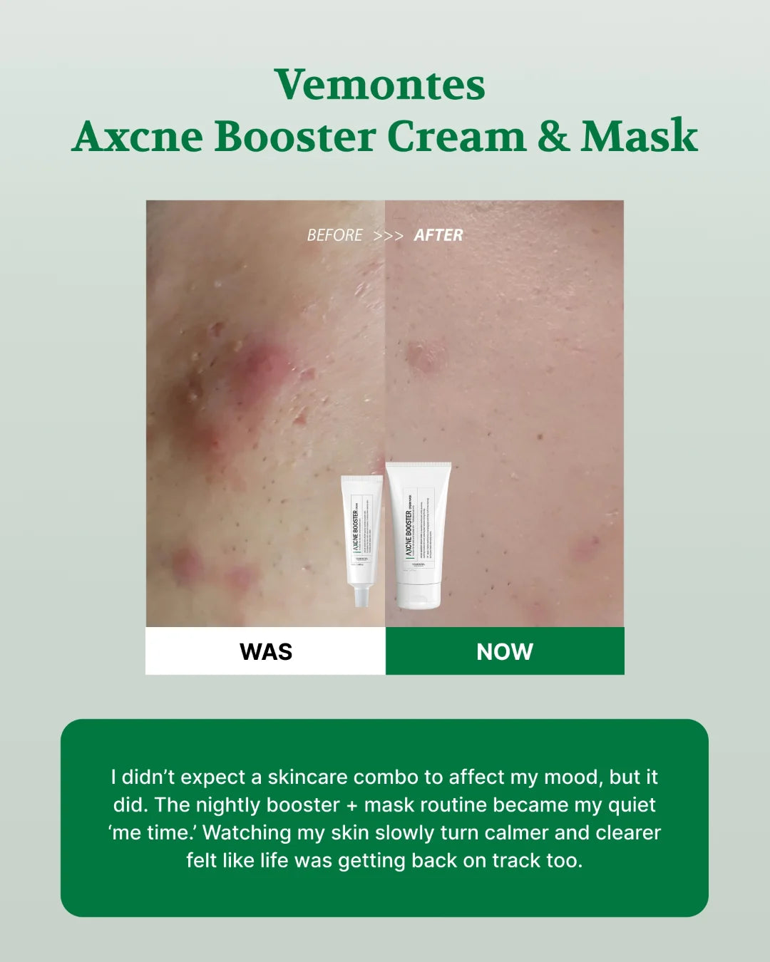 Vemontes Booster Mask & Cream Real Review