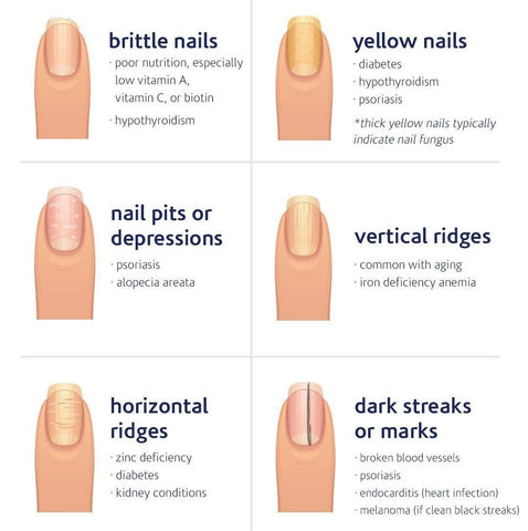 BQAN Nail Health and Care Professional Insights and Essential Tools nail photos