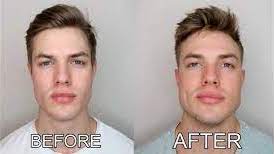 10 Chewing Gum Jawline Before and After Pictures – WOW!
