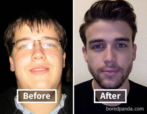 23 Jawline Before and After Weight Loss Pictures – AMAZING!