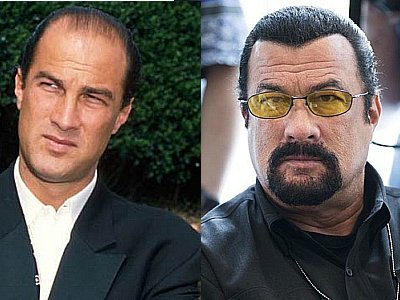 steven seagal hairline