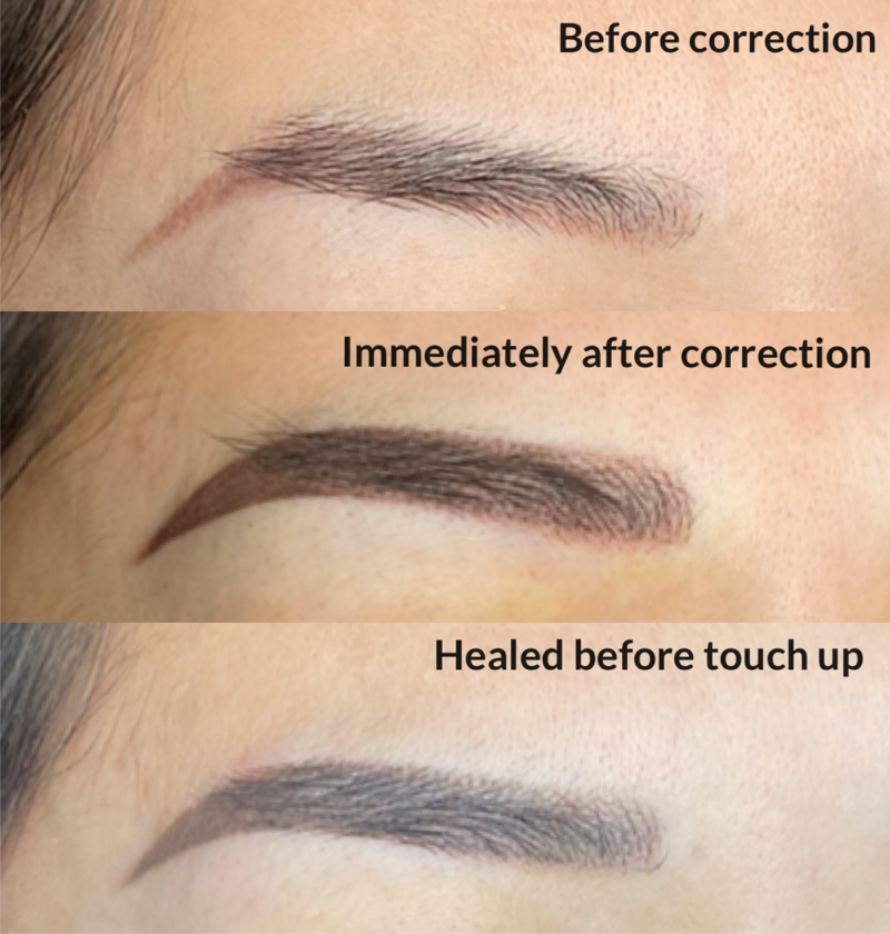 Brow Correction | Arch Angels | Eyebrow Tattoo Removal